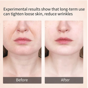 Face and Neck Tightening Massager